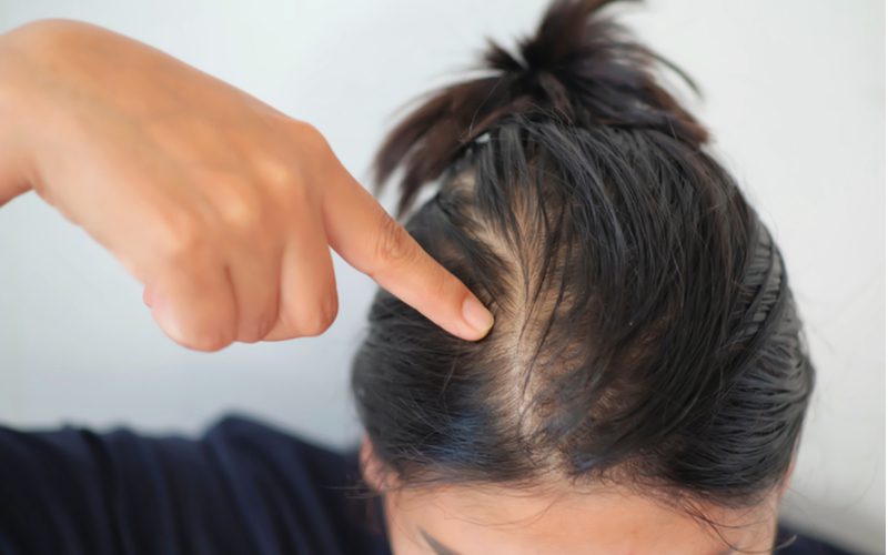 Vrouw met 1a haar die naar haar hoofdhuid wijst