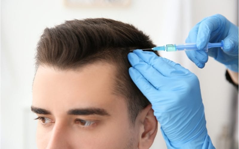 Man krijgt zijn haar verdoofd voor een stuk over haartransplantatie kosten