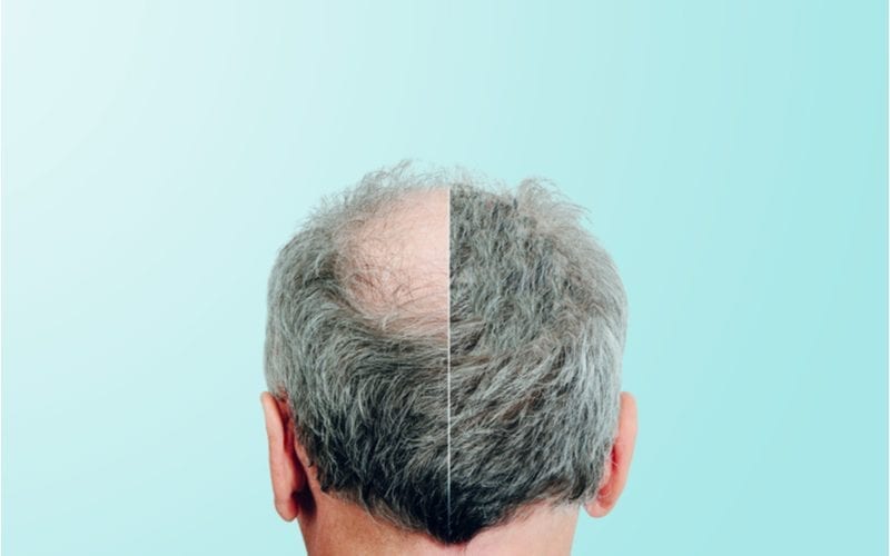 Afbeelding van een man die met zijn halve hoofd voor een blauwe muur staat voor een stuk over haaruitval shampoo