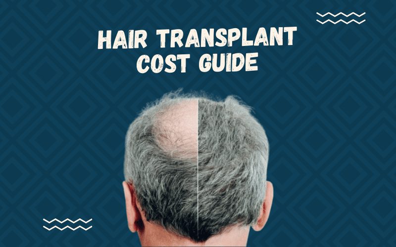 Afbeelding getiteld Haartransplantatie kosten met een man met een side-by-side voor en na afbeelding