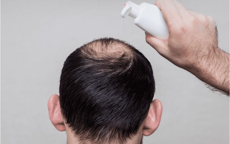 Beeld van een man die de beste shampoo tegen haaruitval op zijn hoofd giet in een studio, gezien van achteren