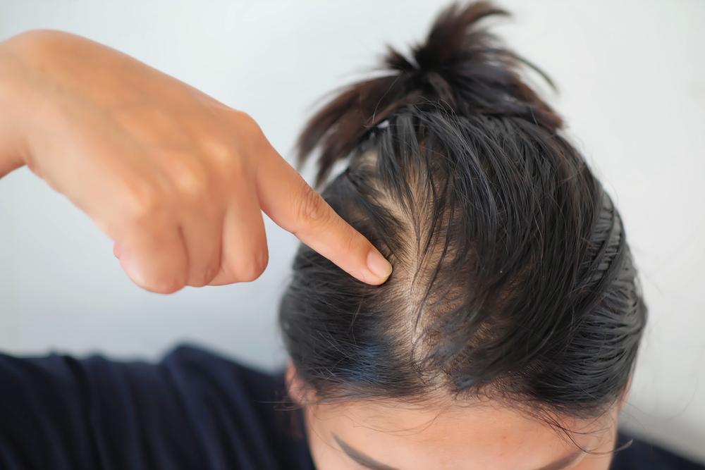 Vrouw met vet haar vraagt zich af wanneer ze haar hoofdhuid niet moet conditioneren