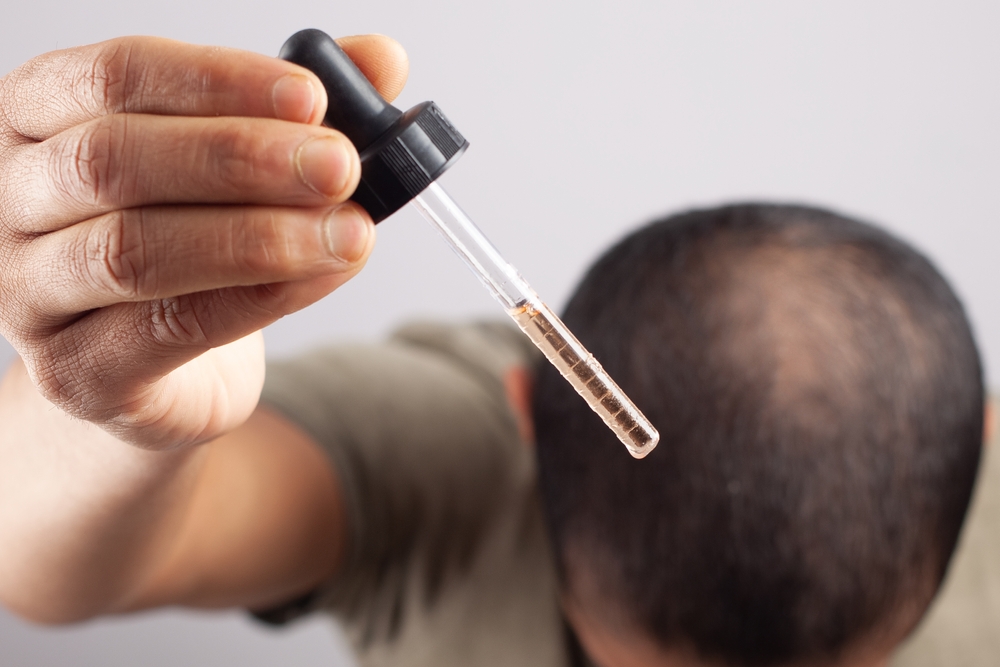 The 7 Best Alternatives to Minoxidil to Know About in 2022