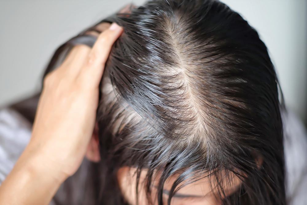 How to Get Oil Out of Hair