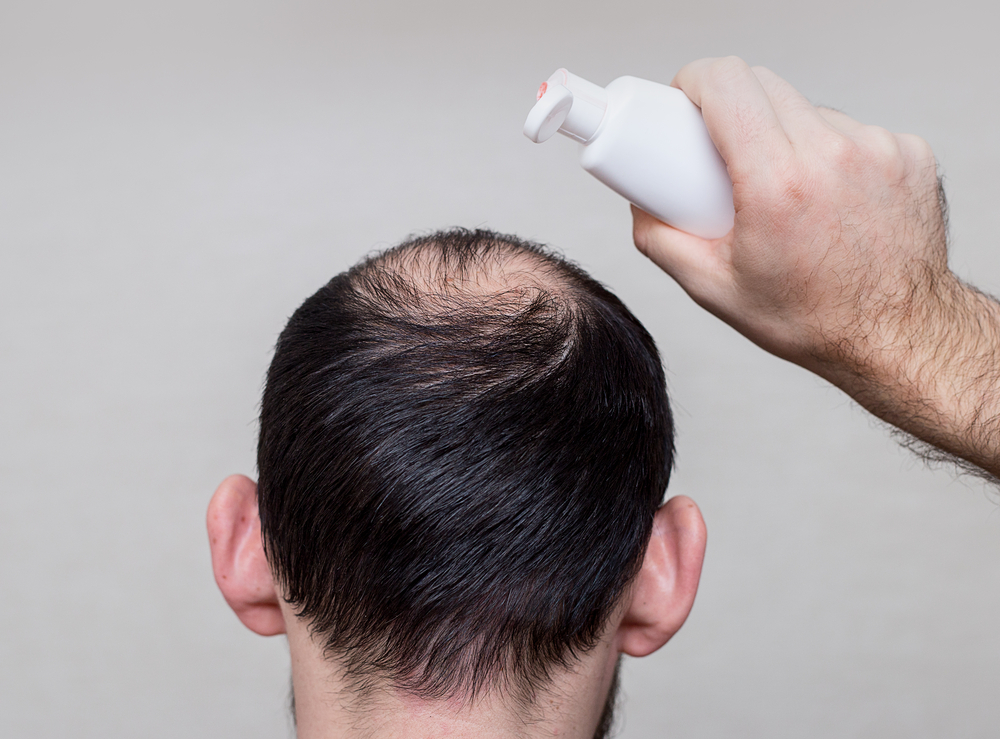 The 7 Best Products for Thin Haired Males in 2022