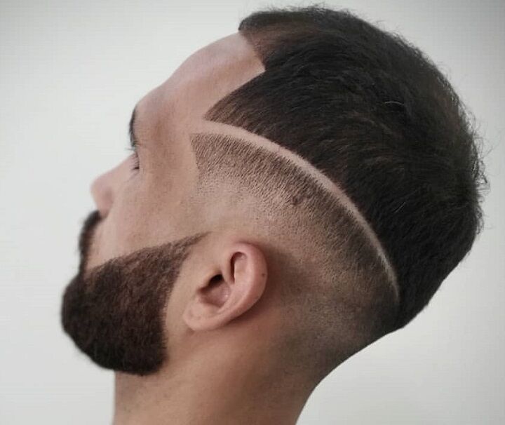 Hard-Line Undercut 