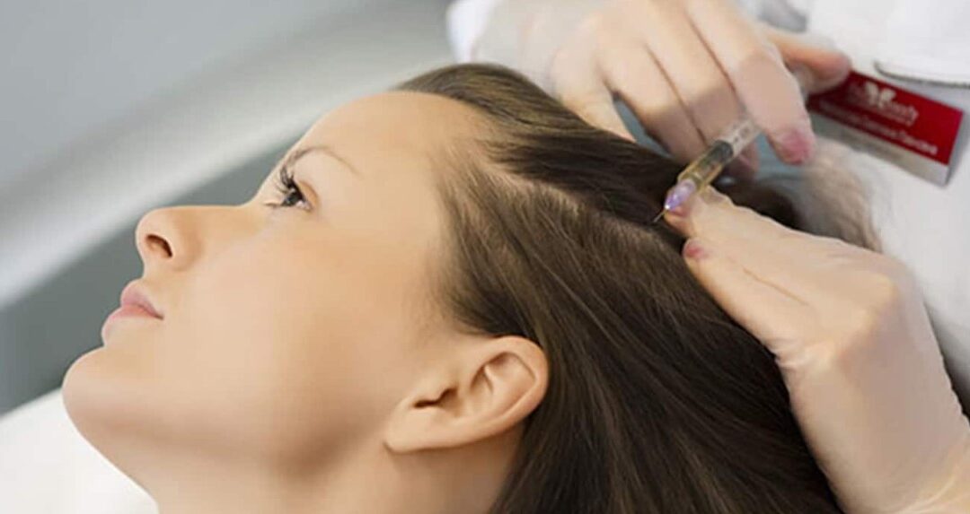 Wat is Mesotherapie en stimuleert het de haargroei?